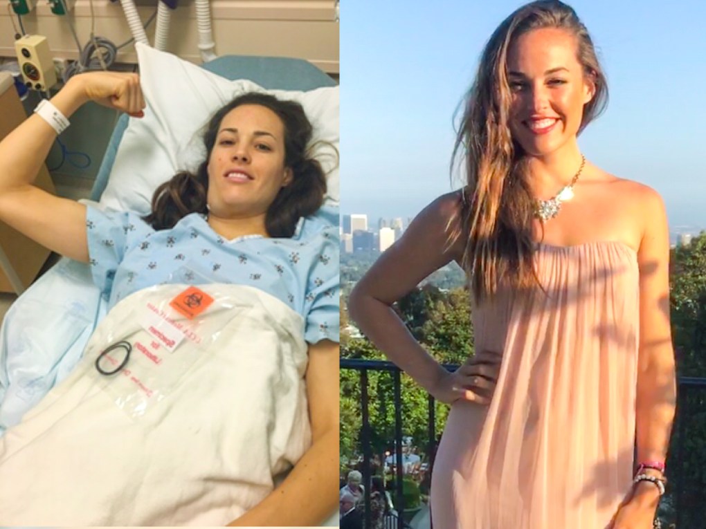 Delfina - Before + After